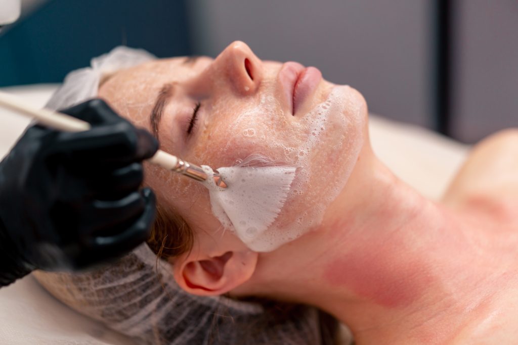 Azelan Rx Peel