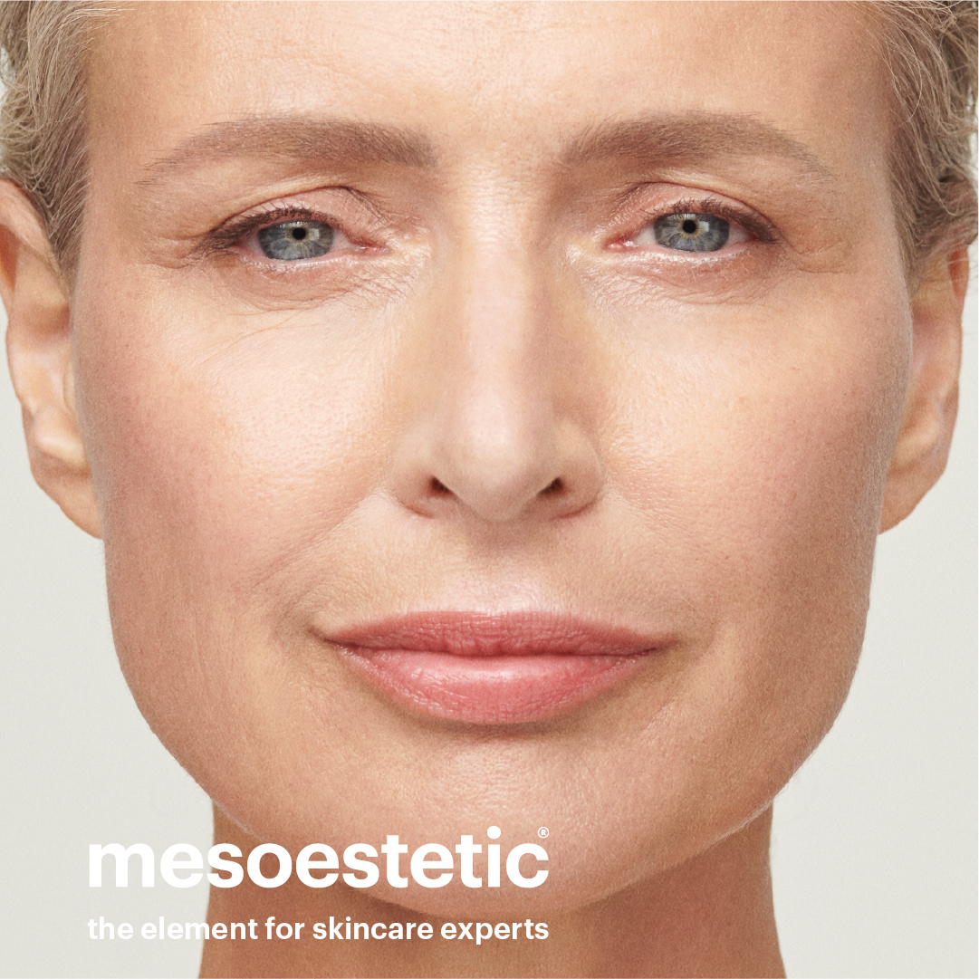 mesoestetic_model_IG POST (3)